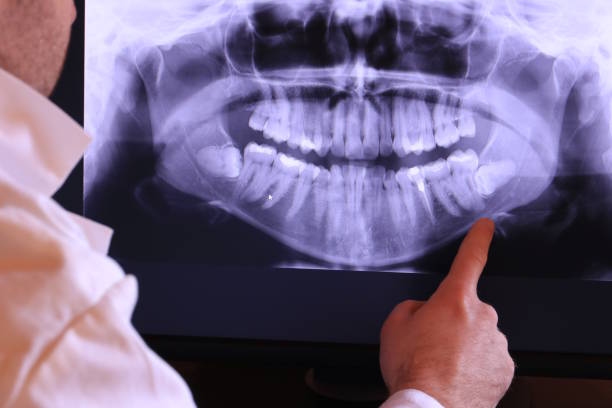 Best 24-Hour Emergency Dental Care in Graham, TX