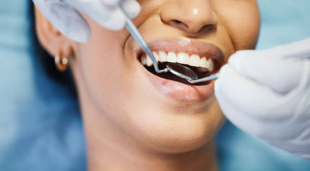 Best Dental Abscess Treatment in Graham, TX