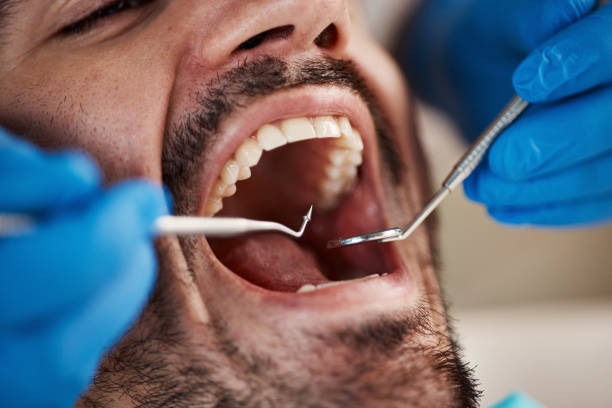 Best Emergency Dental Care for Sports Injuries in Graham, TX