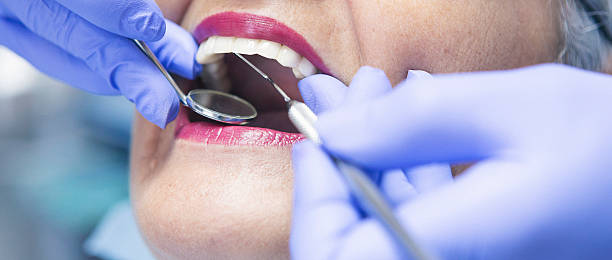 Best Walk-In Emergency Dental Services in Graham, TX